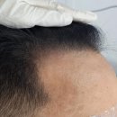 프로닷스칼프