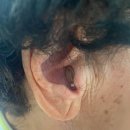 부산독일보청기 이미지