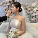 웨딩 피부관리로 받은 튠라이너 튠페이스 후기! 리프팅 부작용 붓기까지 총정리
