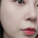 로아메디