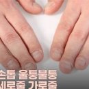 손톱 가로줄 세로줄 건강이 안 좋다는 신호일 수도 있습니다. 이미지