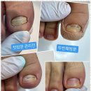 진스케어
