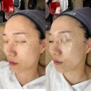드림메디컬 | 판교 피부관리 후기, &lt;올가드림뷰티 판교고등점&gt; G드림 메디컬 관리 &amp; 클렌징바 체험기