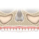 림플란트치과의원 이미지