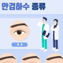 중증 근무력증 증상 및 치료 (눈꺼풀 처짐, 복시, 연하곤란) 이미지