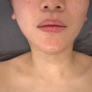 유은 에스테틱 | [파주댁 vlog] 파주 1인관리샵, 야당 운정피부관리 라피네에스테틱 온다리프팅 후기