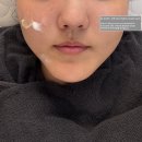 이마트에브리데이 일광삼성점 | 일광피부관리 올가드림뷰티 일광점 모공관리 두피관리 솔직후기