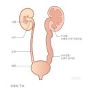 신우약국 | 임신22주 증상과 일상 정밀초음파 태아 신우 길이 늘어남 태아 수신증