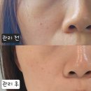 e고운피부 | 신림 에스테틱 여운, 예신 피부관리 받고 피부결 달라진 후기