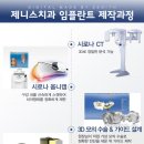 제니스치과 네이버블로그
