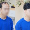 다모란 네이버블로그