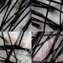 숙등 지하철역 | 지친 내 머릿속 힐링💕 두피디톡스로 부산두피관리 ,올가드림뷰티 덕천포레나점