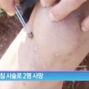 봉침 한의신문