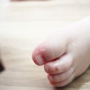 아기 모기약으로! 상처 연고로! 만능천연연고 포카우팜 티트리 레미디 :)