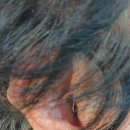 독일렉스톤보청기 의정부점 이미지