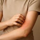 신경자 | CRPS 통증 증상 ,원인_복합부위통증증후군