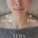 (주)예하 | 주안피부관리 찐 데콜테 맛집 예하 에스테틱 후기