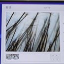 수지로112번길 | 용인수지탈모 고민 되면 꼭 가야 하는 곳, 용인수지두피 스케일링 닥터모락 후기