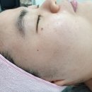 비앤제이인테리어 | 다사세천피부관리실/피부관리맛집/피부관리/비앤제이뷰티에서 뉴알라딘필링했어요~