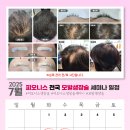 피오케이