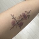 1 | 부산 부산진구 명함사이즈 문신제거 1~5회차 후기