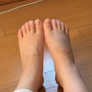 [리스프랑 인대 파열 -1] 엥 내가 수술이라니