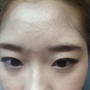 함익병피부과의원 | 2020년부터 방문한 함익병피부과 n년차 후기 / 위치,여드름 원인 , 가격 등