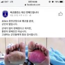 육군 훈련소 페이지에 올라온 행군 끝낸 발 사진 이미지