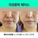 뷰티비젼