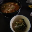 소망안과의원 | 서울 여의도 라섹 병원 솔직후기 제이씨빛소망안과, 통증과 회복과정 렌즈제거