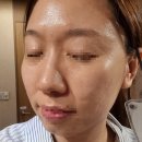 미플 정릉점 | [성북구/미플/정릉점] 피부관리 *아이스테라피* 후기