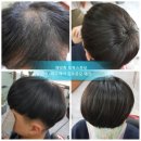 김호증모