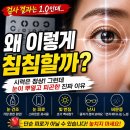송탄성모안과의원 네이버블로그