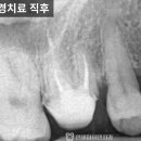 종로크라운 이미지