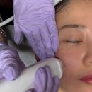 다나은메디컬 | 대구 남구 피부관리잘하는곳 J메디스킨랩 울써마지 솔직후기