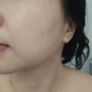 롯데마트 앞 | 만족했던 계산동 리프팅관리, 미플 스파 롯데마트 계양점 물방울 리프팅 후기