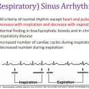 호흡리듬과 자율신경, 심장박동과의 상호연관성 respiratory sinus arrhythmia 이미지