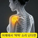 남대문명동정형외과의원 | 명동정형외과, 어깨에서 '딱딱' 소리 난다면 - 위험 신호일까 정상일까?