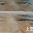 광주시립인광치매요양병원 노컷뉴스