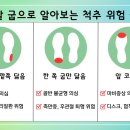 &#34;허리건강, 신발 굽 닳는 부위로 측정할 수 있어요&#34; 이미지