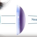 비전옵틱스 이미지