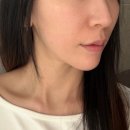 (주)셀스타 | 한남동피부과 줄기세포 아란셀 내돈내산 후기🩵(킴카다시안,헤일리비버 줄기세포주사 스킨부스터!)