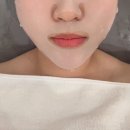 인더마화수분 | 동작 인더뷰티 이수역에스테틱 수분 미백 웨딩관리 후기