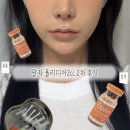 조을 | 수원 인계동 피부과 콜라겐주사 팔자올리디아2cc 2차후기