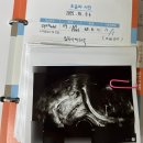 밝은산부인과의원 이미지