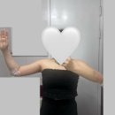 멍멍멍 | [후기] 팔 무한람스 시술 - 1주차 기록(붓기, 멍, 압박복. 메조지분주사)