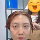 딥 | 진접 미용실 라라스토리 딥레이어 클리닉 후기