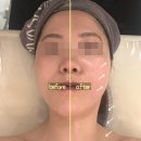 서면피부관리 제이민에스테틱 관리 후기👰‍♀️ㅣ부산웨딩케어 • 윤곽관리 추천