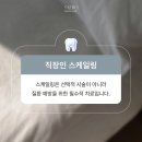 화수치과의원 | 스케일링 건강보험 알아보고 직장인 스케일링! (강남역스케일링)
