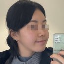 침사랑 한의원 | 홍조관리 새살침으로 여드름관리까지 되는 강남 여드름한의원